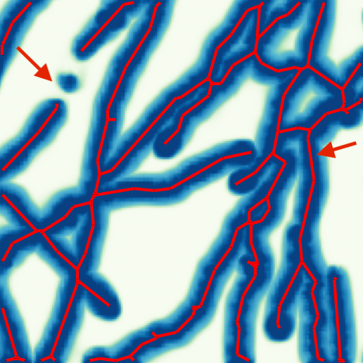 Brain InvMALIS