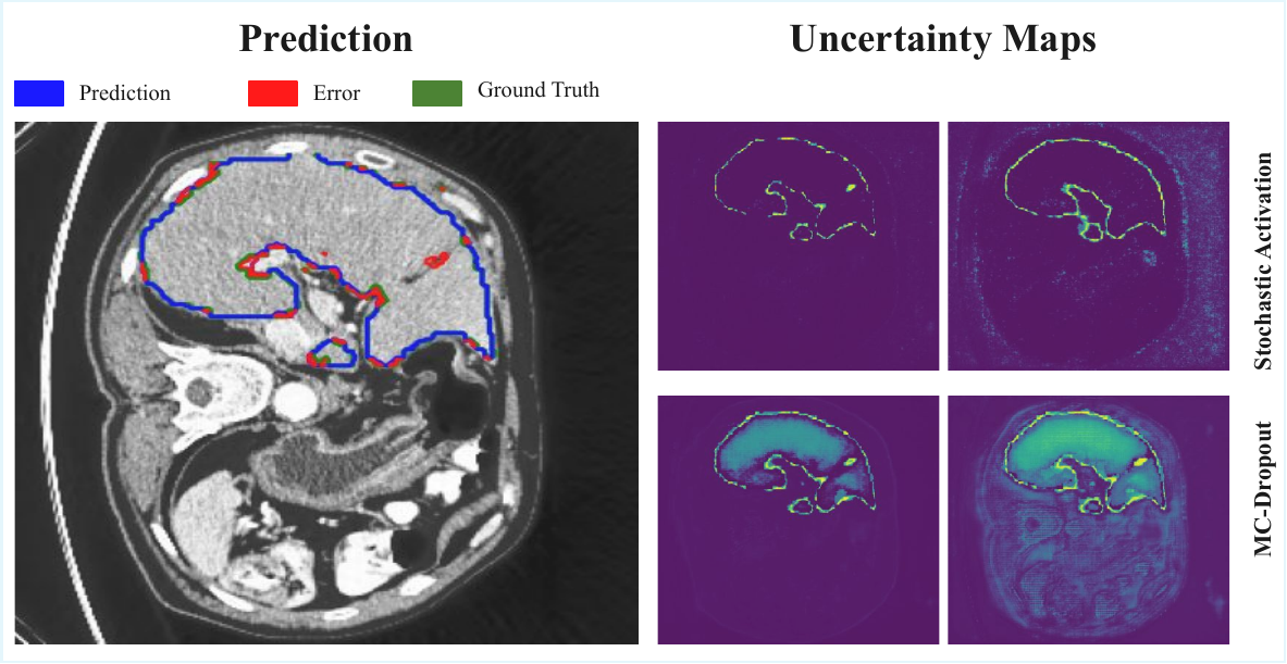 Comparison of stochastic activation and MC-Dropout uncertainty maps on abdominal CT segmentation.